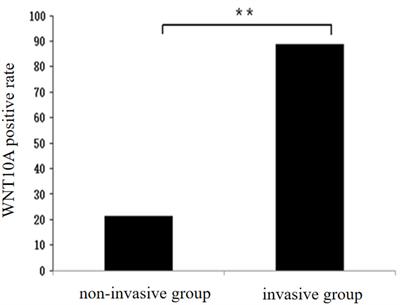 Prediction of the invasiveness of PTMC by a combination of ultrasound and the WNT10A gene